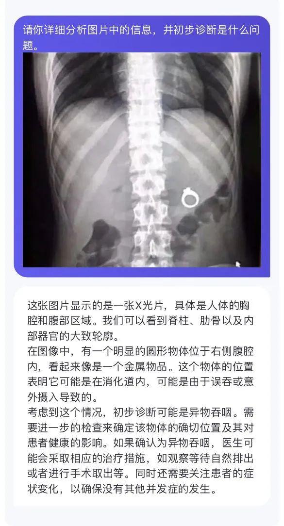 1717446273902.jpg 人工智能将如何彻底改变医疗行业?